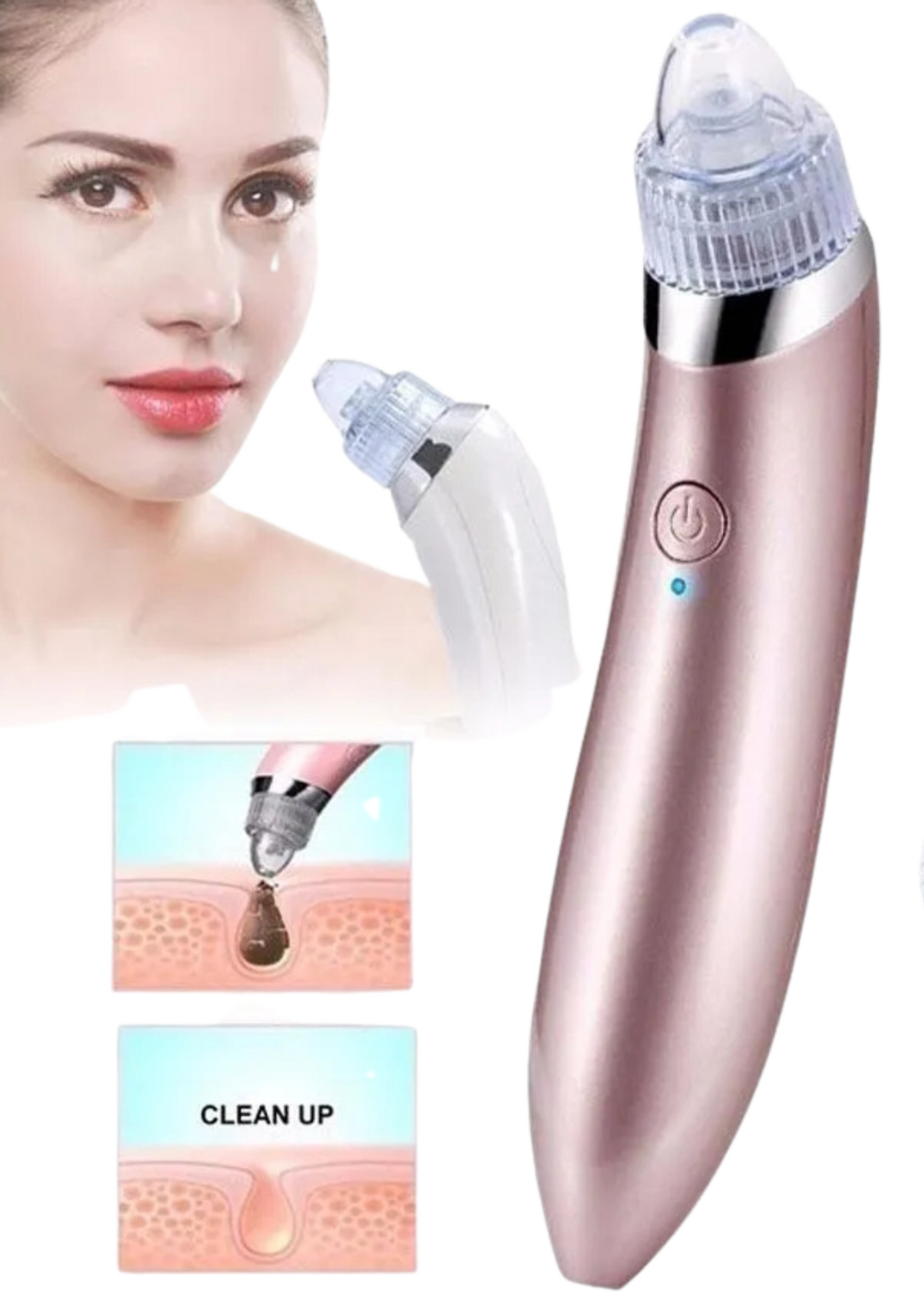SUCCIONADOR DE ESPINILLAS ➕ CREMA FACIAL Y GUIA DE USO PROFESIONAL📑