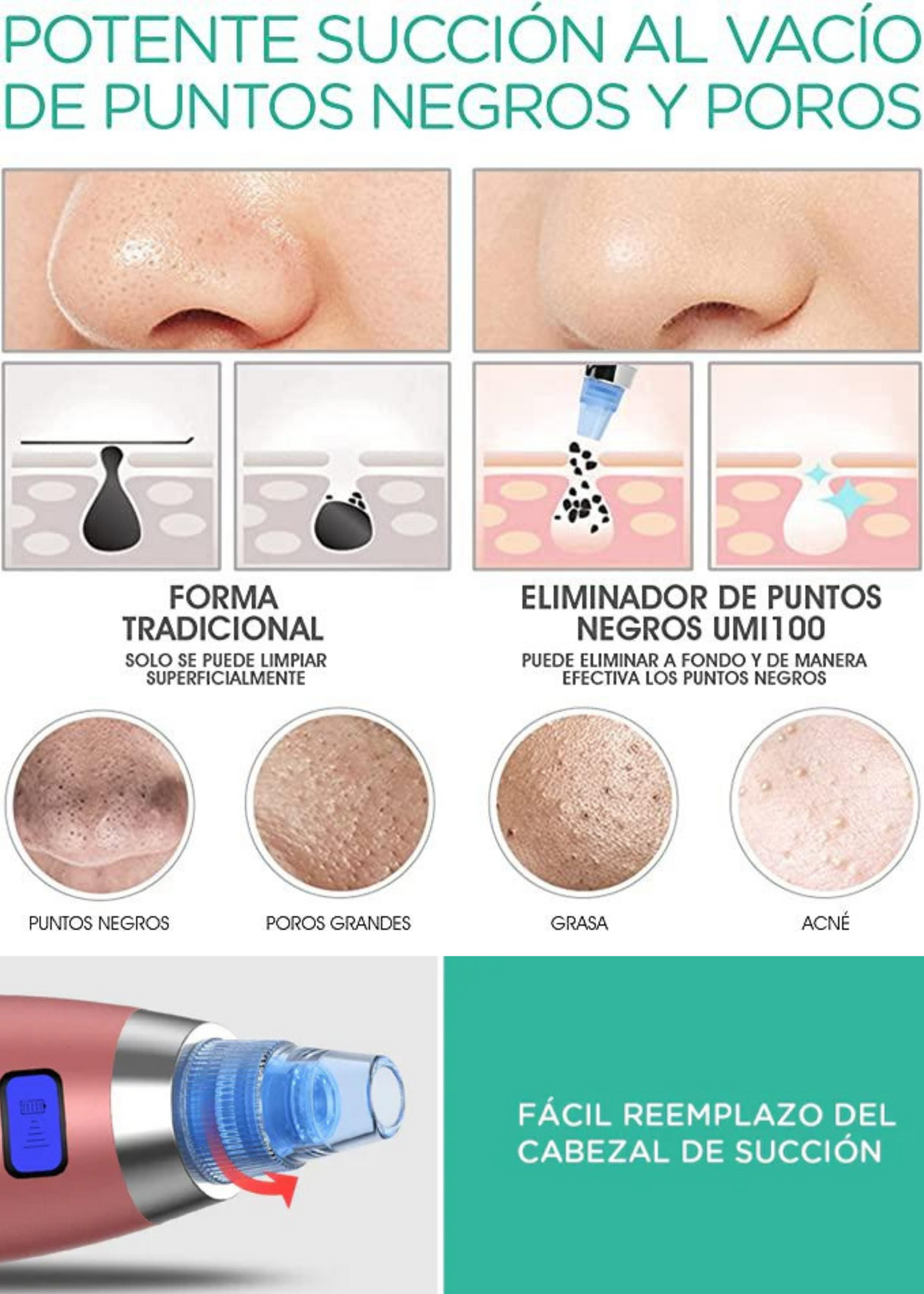 SUCCIONADOR DE ESPINILLAS ➕ CREMA FACIAL Y GUIA DE USO PROFESIONAL📑