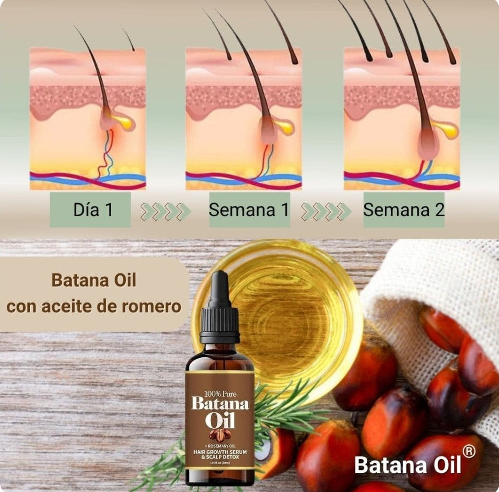 💦2X1 ACEITE DE BATANA PARA EL CRECIMIENTO DEL CABELLO🙆🏻