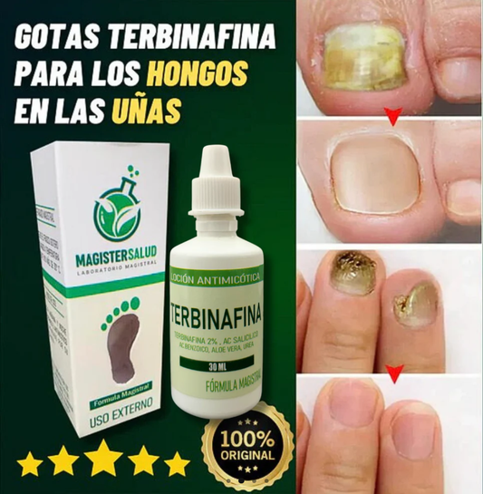 💧2X1 GOTAS DE TERBINAFINA PARA ELIMINAR 🍄HONGOS DE LAS UÑAS❌