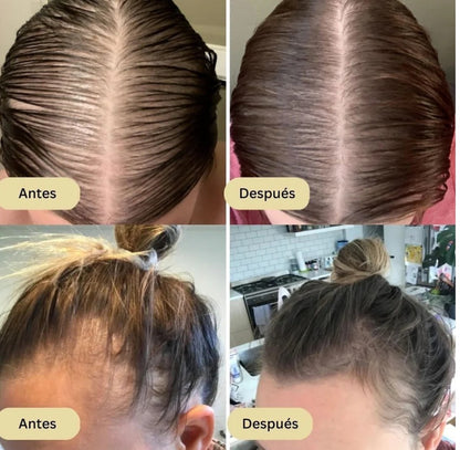 VITA ORGÁNIC-SERUM CAPILAR CRECIMIENTO DE CABELLO EN 15 DIAS